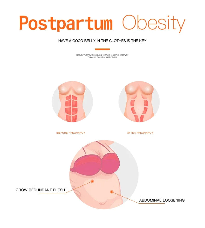 Postpartum Waist Corset – Slimming Tummy Shapewear for Women